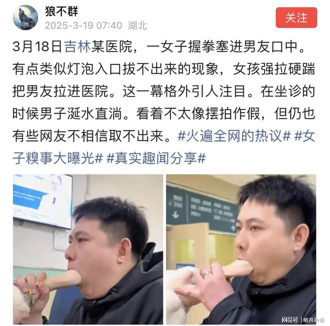 bwin网站：活久见！网传一男子口中被女子握拳塞进拔不出来在坐诊涎水直淌(图1)